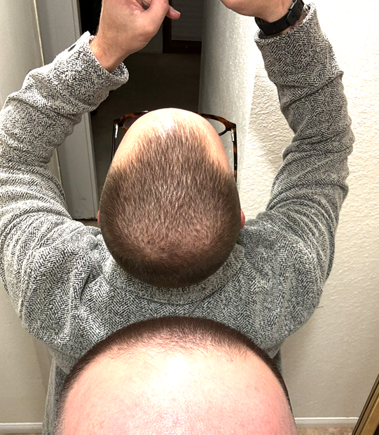 Before
