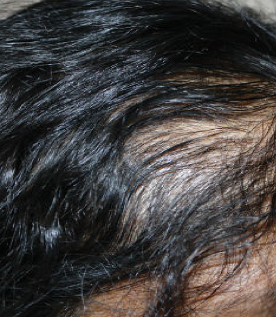 After